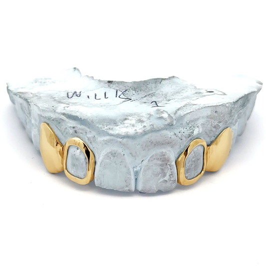Custom 4 Teeth - 2 Solid + 2 Open Face Window Grillz