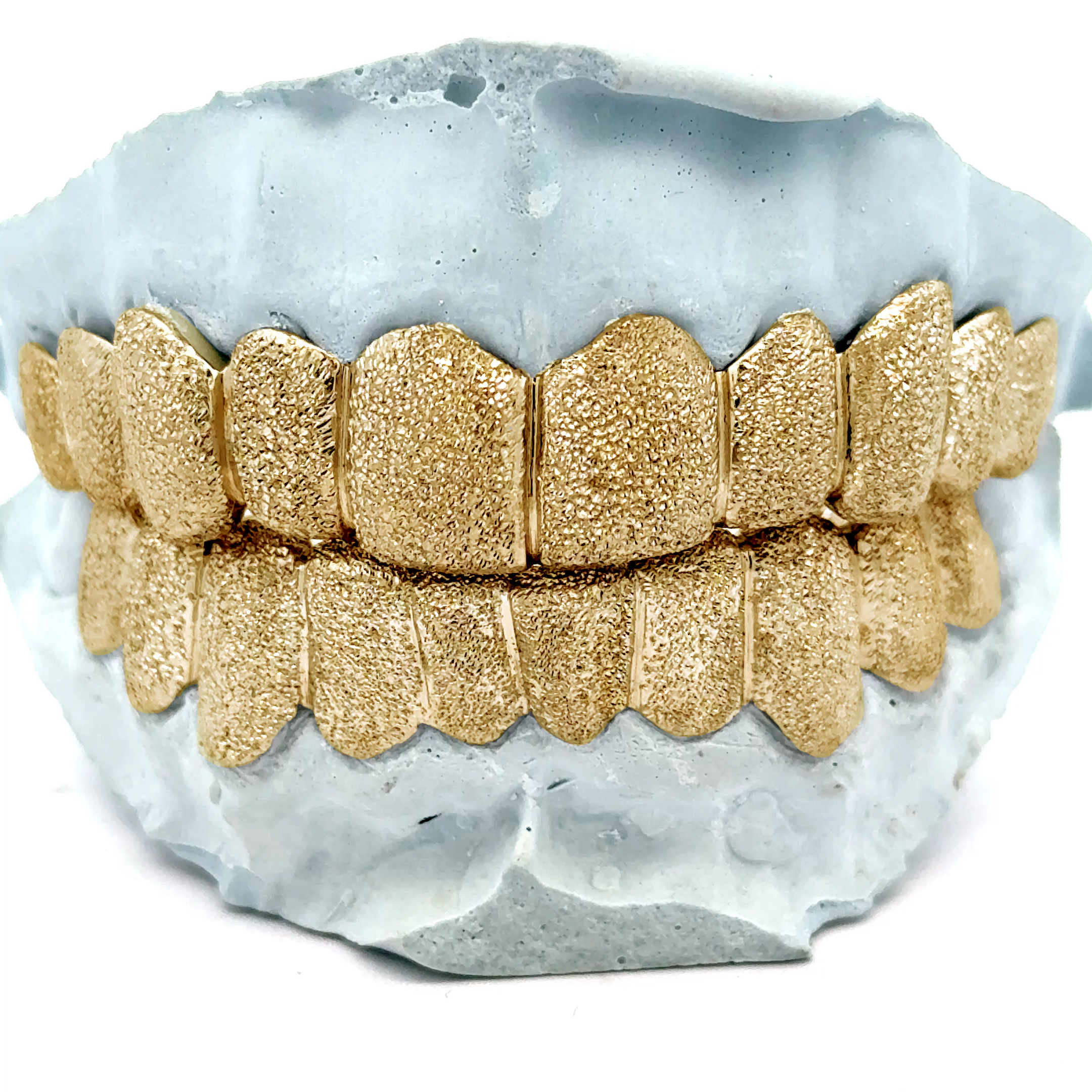 Custom Dust Cut Grillz [SG002] – Jewelry Dog USA | Houston Custom