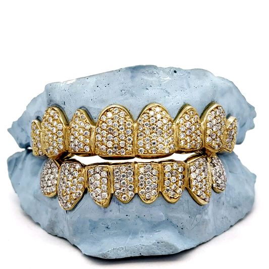 Custom Pave VVS Moissanite HandSet Grillz