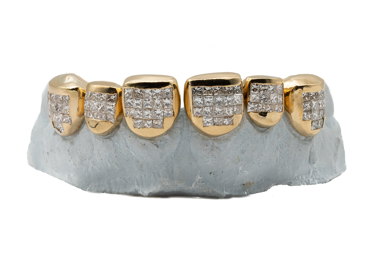 Invisible block set grillz store