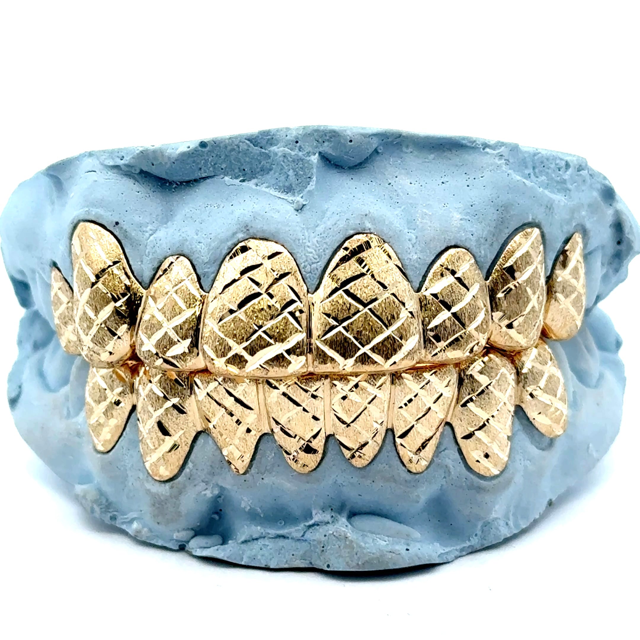 Custom Diamond Dust Cut Gold Grillz [SG009] – Jewelry Dog USA