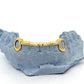 Custom Bar Grillz + Open Face Window Fangs