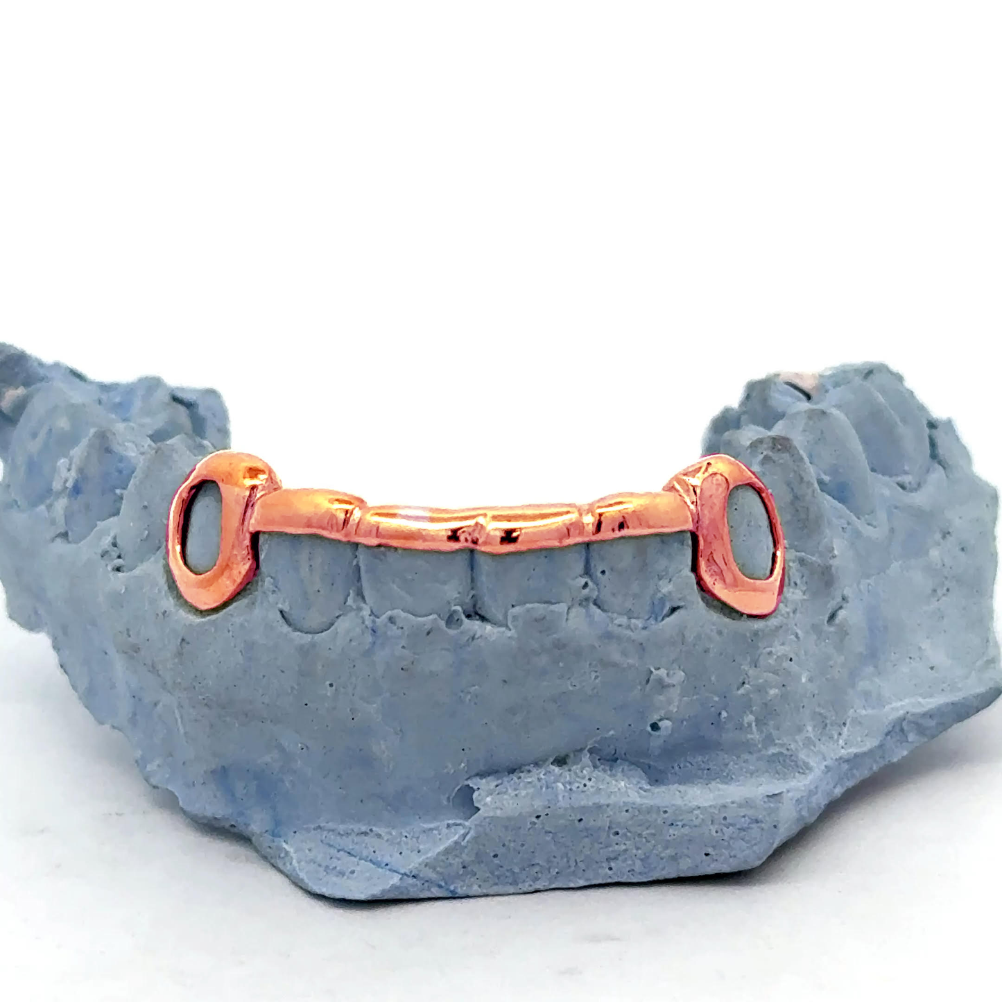 Custom Bar Grillz + Open Face Window Fangs