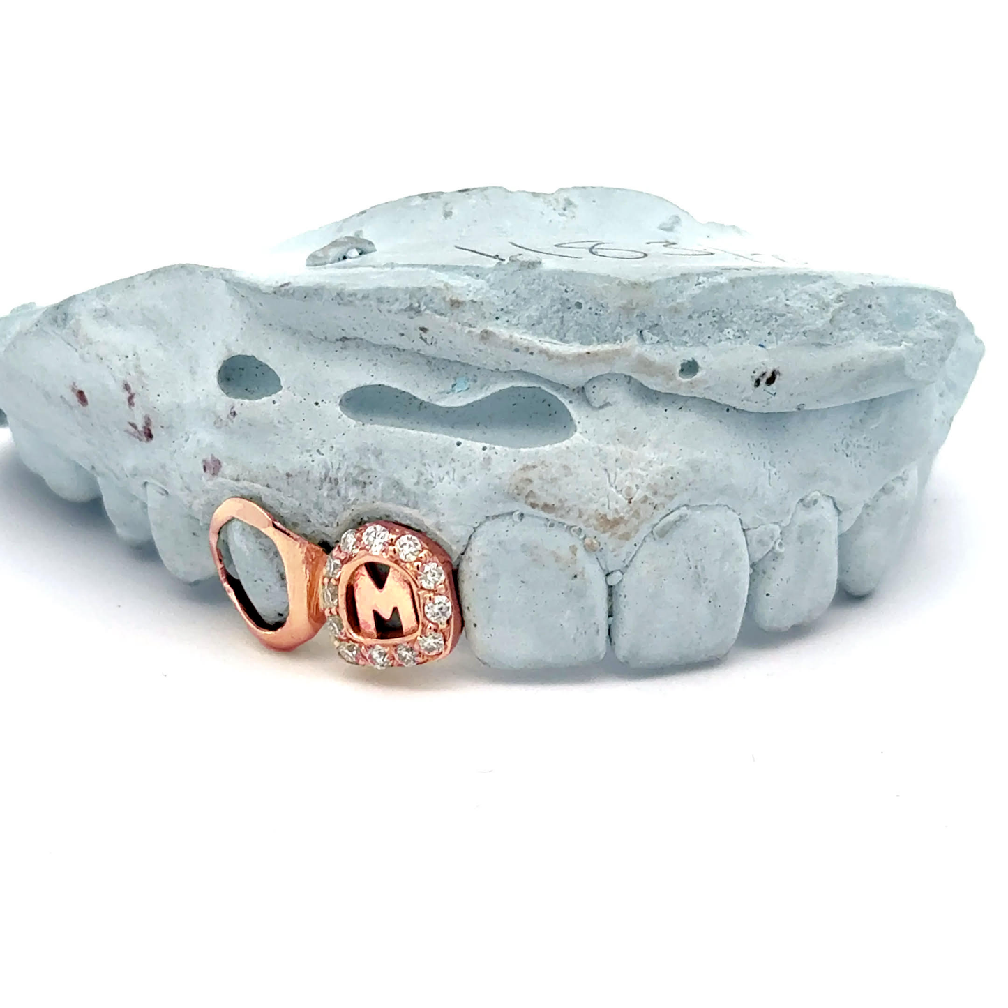 Open Face + Natural Diamond Letter Grillz