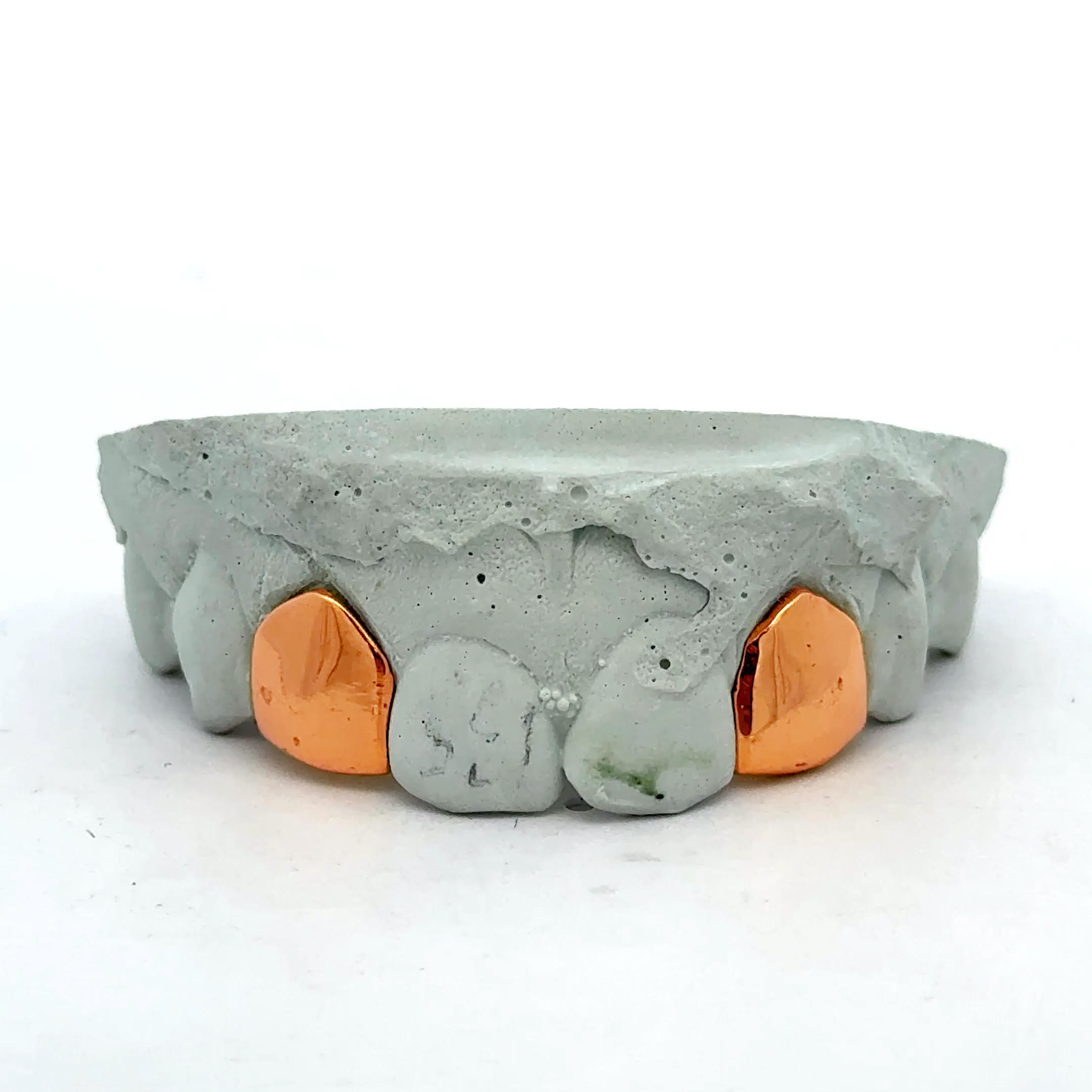 Custom 2 Teeth -  Solid Single + Solid Single