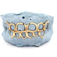 Custom Open Face Gold Grillz [SG008]
