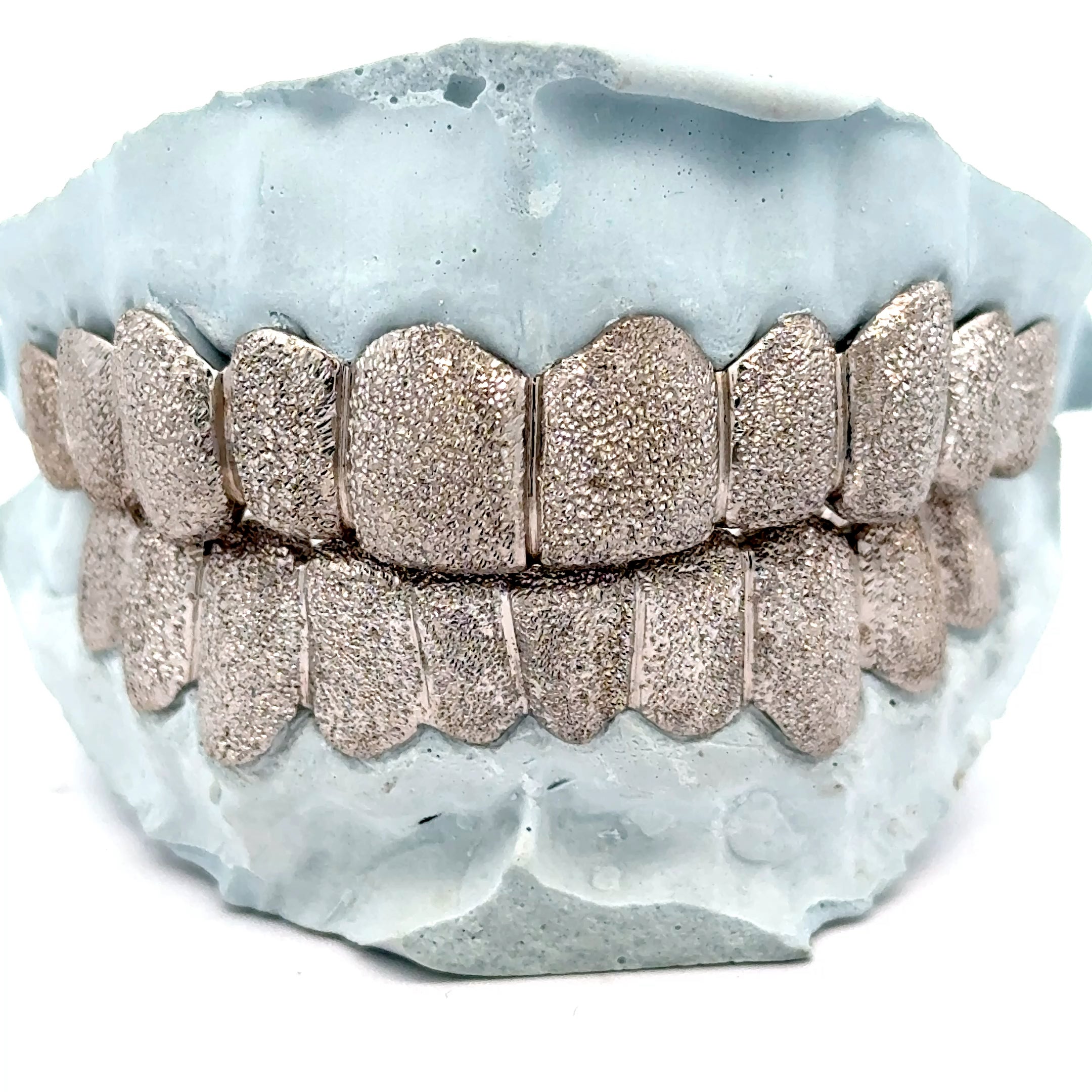 Custom Dust Cut Grillz [SG002] – Jewelry Dog USA | Houston Custom