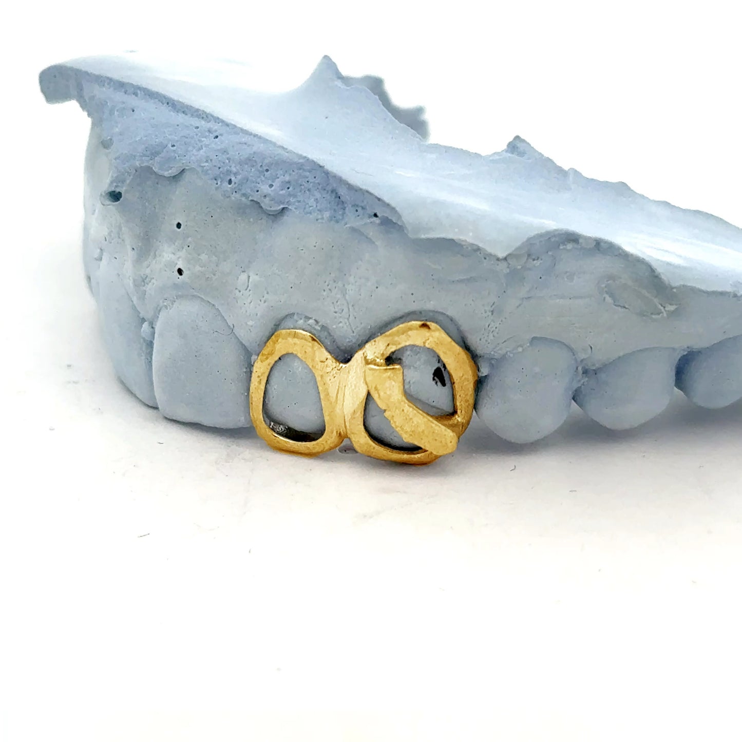 Custom 2 Teeth - Open Face Window and California Grill