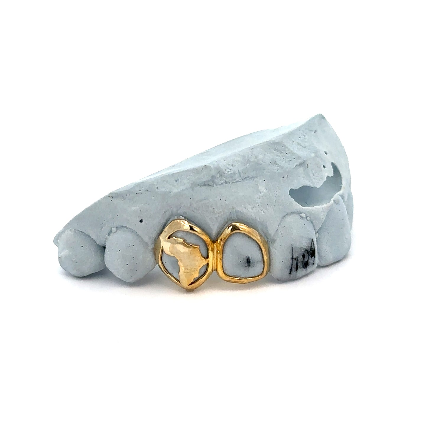 Custom 2 Teeth - Continent Set + Open Face Window