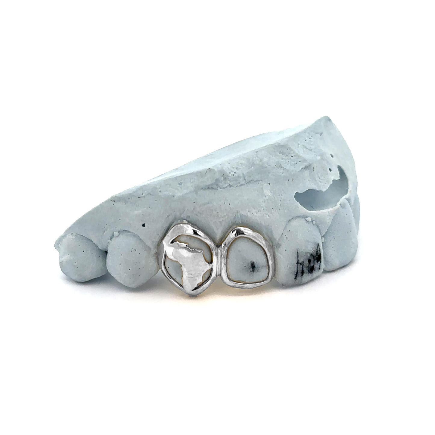 Custom 2 Teeth - Continent Set + Open Face Window