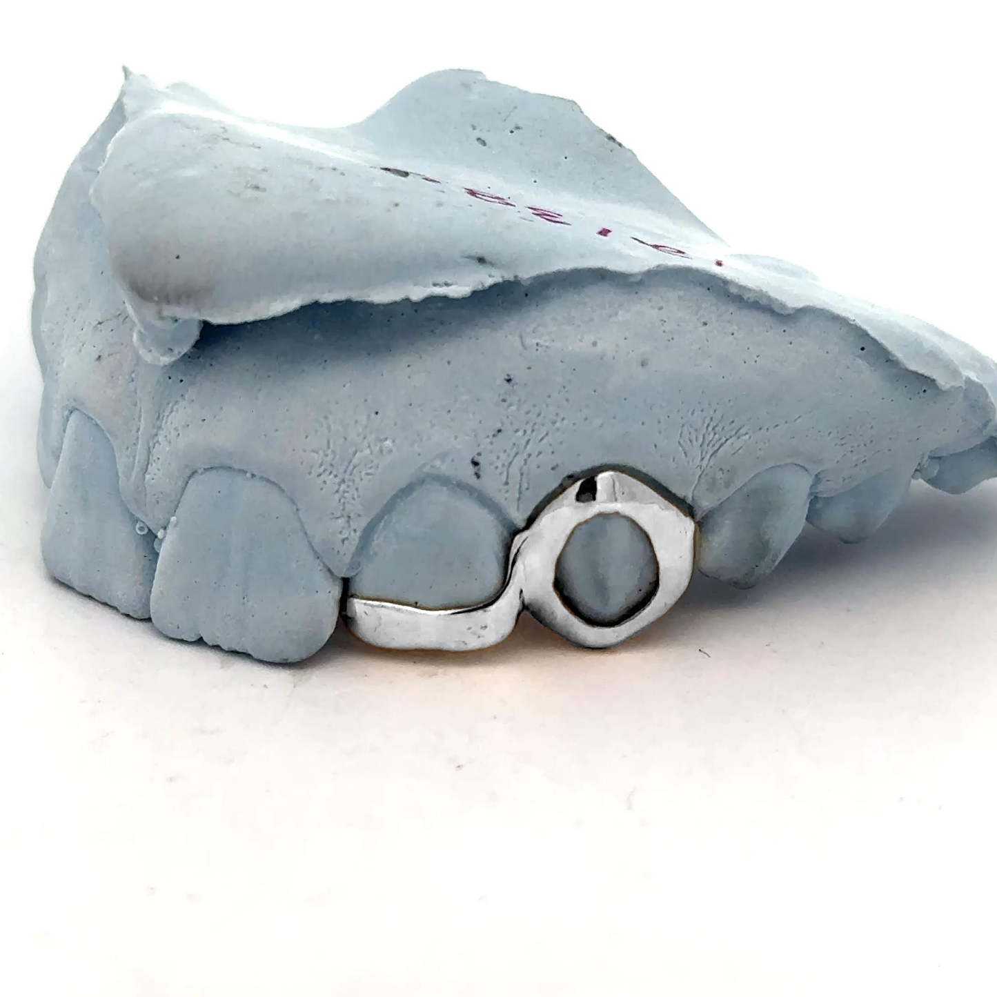 Custom 2 Teeth - Bar + Open Face Window Grillz