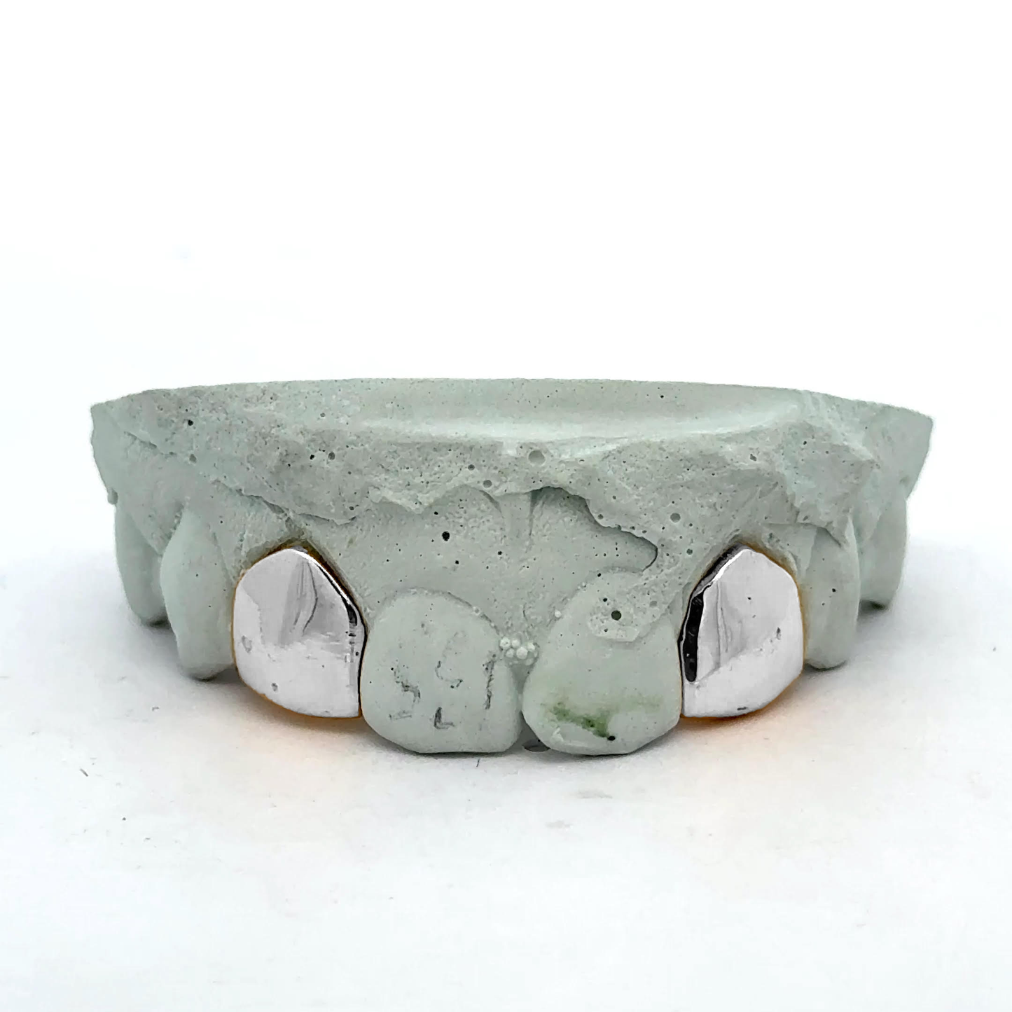 Custom 2 Teeth -  Solid Single + Solid Single