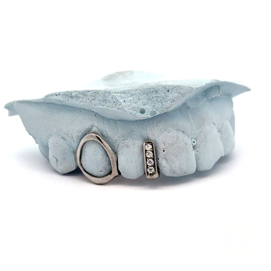 Open Face with Diamond Gap Grillz