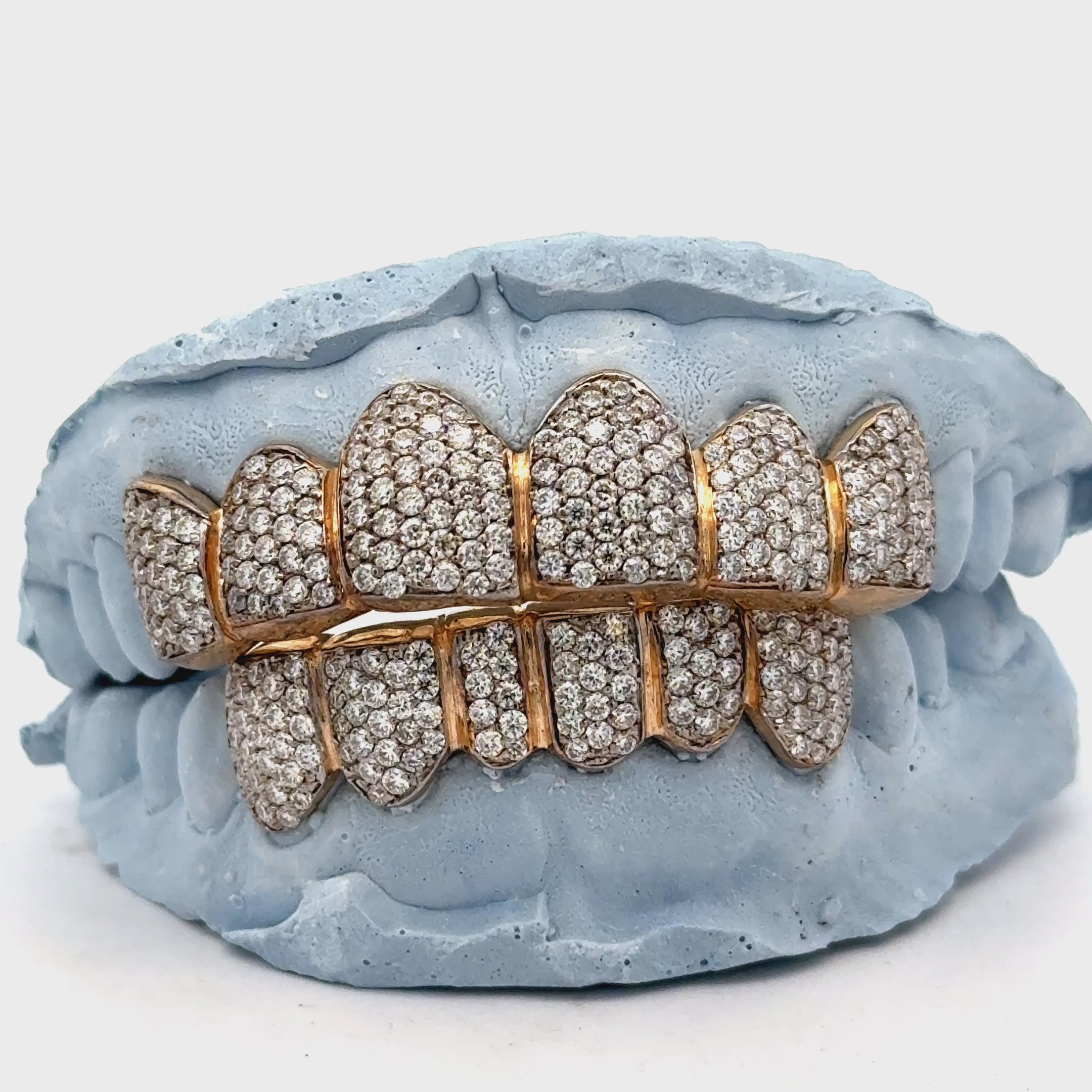 Custom Natural Diamond Pave Setting Gold Grillz [HS 001] – Jewelry