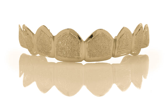 Custom Dust Cut Gold Grillz [SG002]