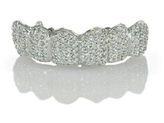 Custom Zigzag Hand Diamond Setting White Gold Grillz [HS 002]
