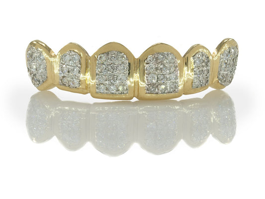Straight Hand Set Diamond Yellow Gold Grillz [HS 005]