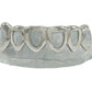 Top and Bottom Combo Dealz - Custom Open Face Gold Grillz [SG008]