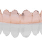 Custom Solid Gold Grillz [SG001]