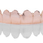 Top and Bottom Combo Dealz - Custom Solid Gold Grillz [SG001]